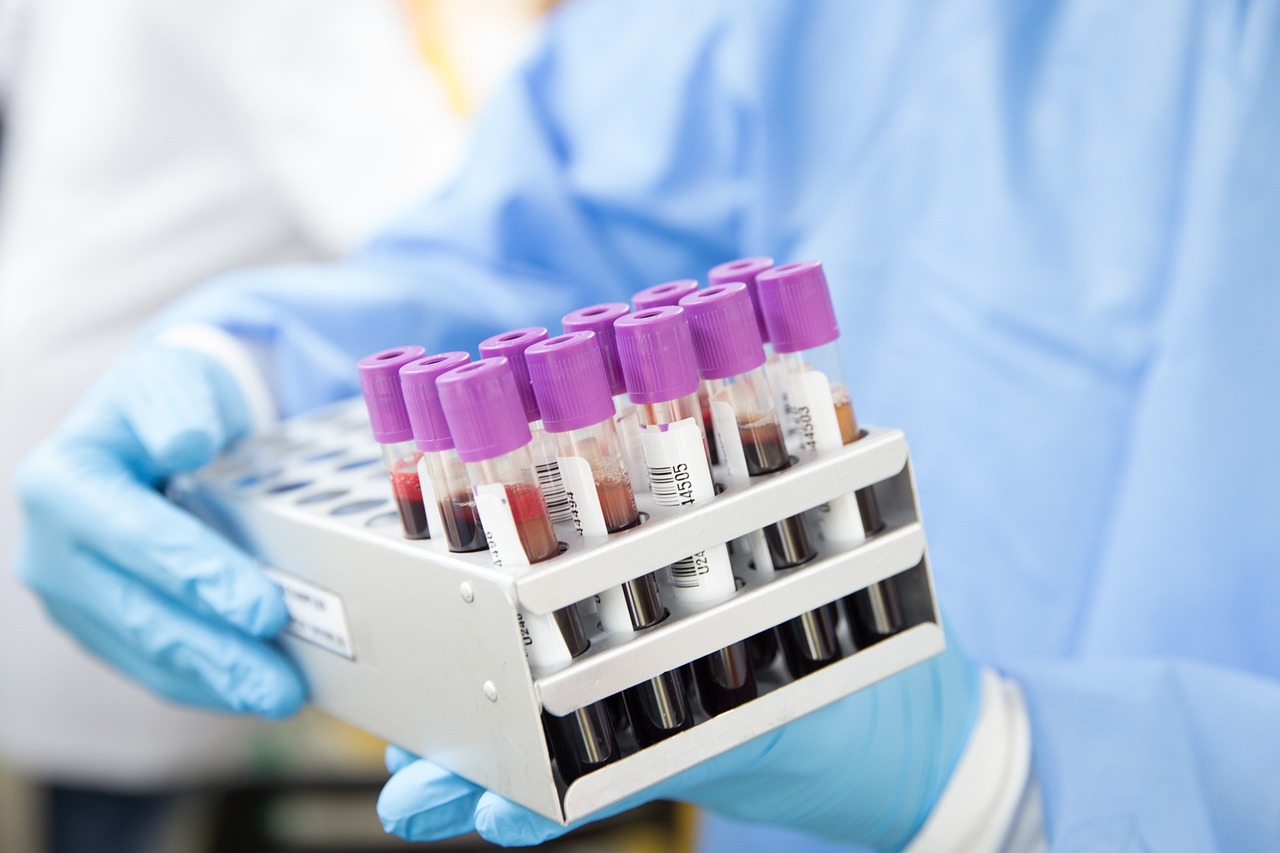 Pic of blood samples