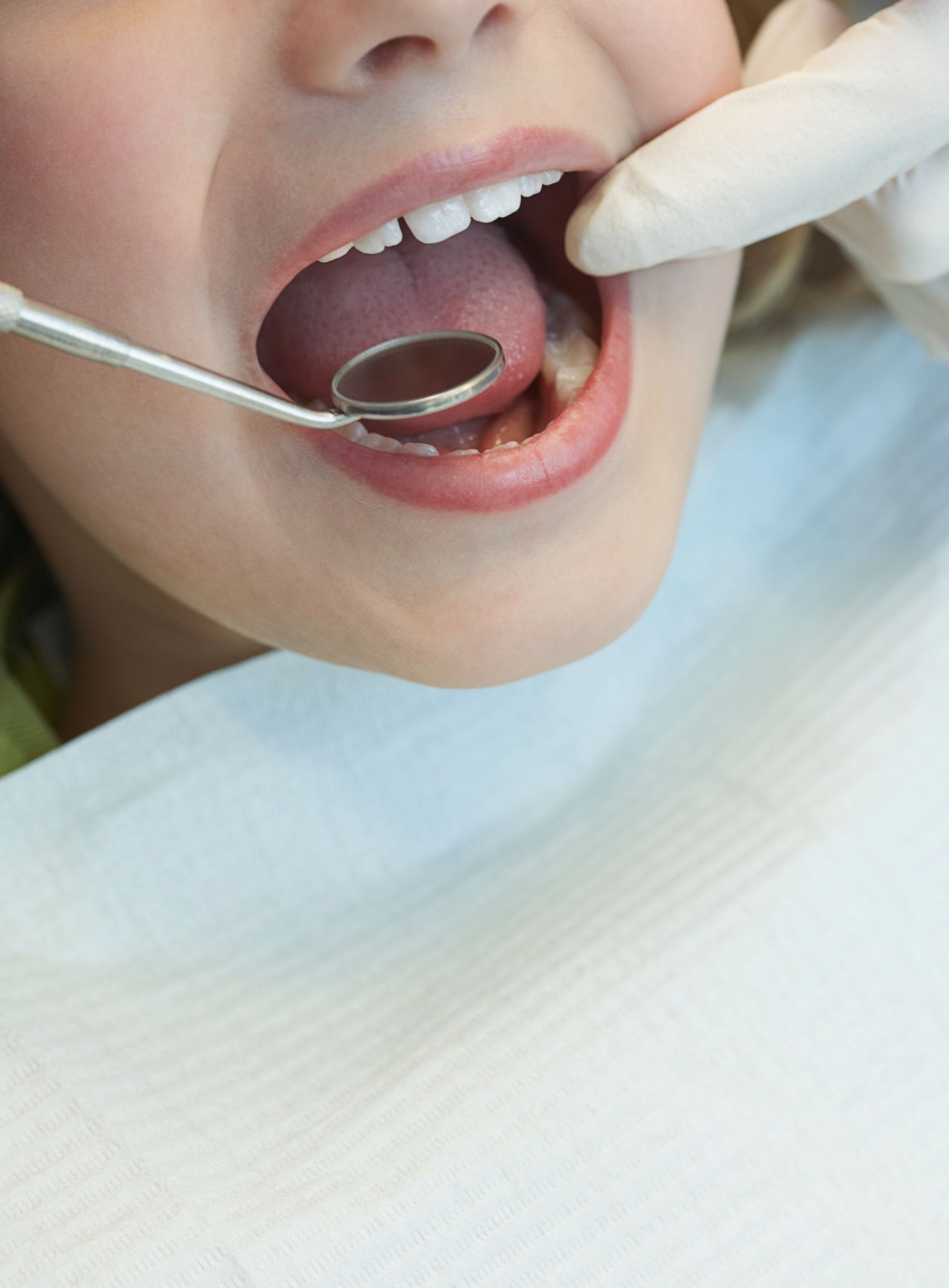 Closeup of a young girl's teeth being examined by a dentist.