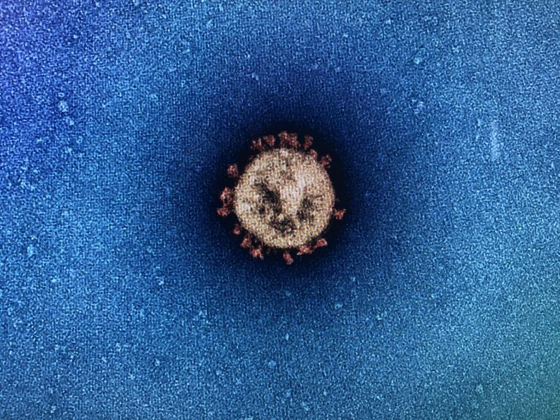 A Transmission Electron Micrograph of SARS-CoV-2 isolate VIC-01 cultured from Australia’s first case of CoVID-19 in 2020. 
