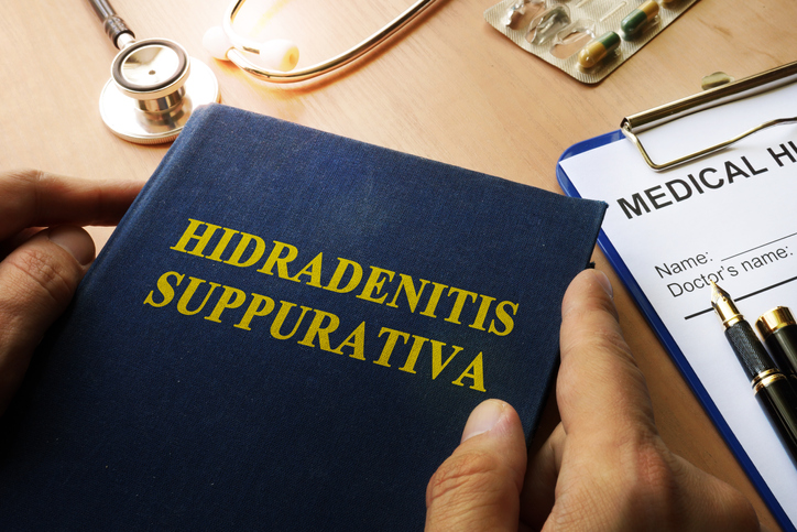 A book on a doctor's desk with the title 'Hidradenitis Suppurativa