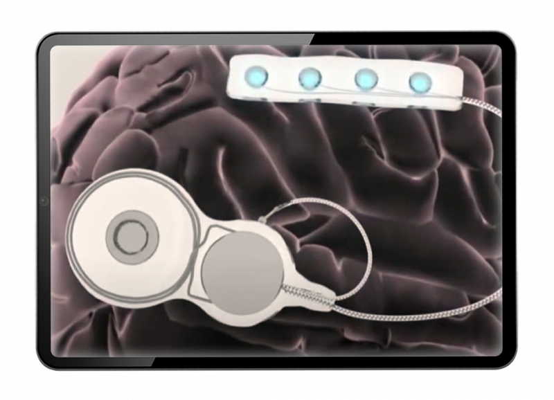 2018 Minder puts round-the-clock seizure monitoring within reach